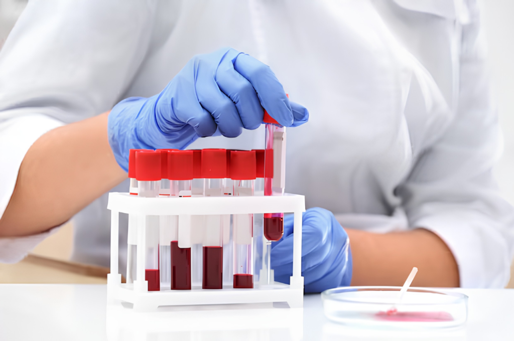 Why Vitamin Levels Matter: The Role of Blood Testing in Everyday Health